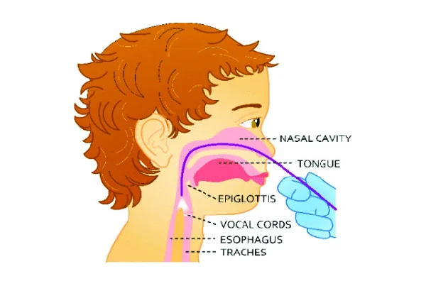 Fiber Optic Laryngoscopy